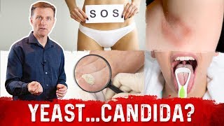 Yeast Infection vs Candida Infection Is there a Difference – DrBerg [upl. by Iturk]