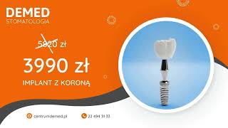 Implant z koroną 3990 zł [upl. by Arrais]