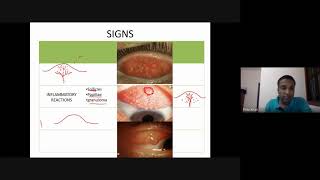 Conjunctival diseases [upl. by Htaek261]