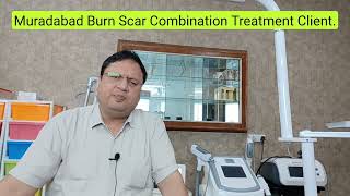 Muradabad Burn Scar Combination Treatment  Results  Keloid  Hypertrophic  Kayakalp Laser Clinic [upl. by Hama]