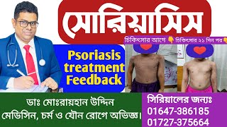 সোরিয়াসিস  Psoriasis Treatment Feedback  Psoriasis  চর্মরোগ  Skin Diseases  DrRayhan [upl. by Lynnette]