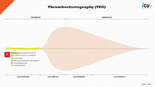 Thromboelastography TEG Explained [upl. by Jaret]