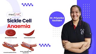 Sickle Cell Anaemia  Pathogenesis  Factors  Diagnosis by DR Priyanka Sachdev  MedLive [upl. by Hearsh]