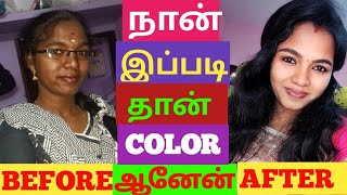 How I change my skin tone  100℅ True  Skin whitening tips  skin transformation Before amp After [upl. by Hartman]