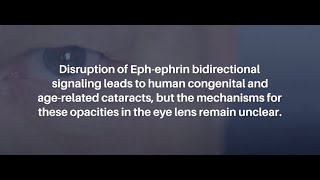 EphA2 Signaling in Eye Lens Aging WildType Knockout and Aging Mice  AgingUS [upl. by Phelips]