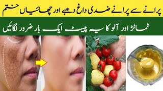 Skin care home remedies for glowing skin  Miss SK Hacks [upl. by Niwle]