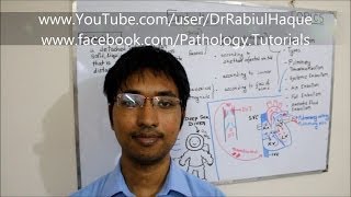 Embolism  Definition Types Pathogenesis Clinical Consequences HD [upl. by Lalla38]