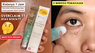 BONGKAR Kebenaran Eye Serum MS Glow  My Honest Review [upl. by Boswall]