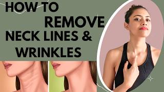 HOW TO REMOVE NECK WRINKLES NATURALLY  HOW TO REDUCE NECK LINES amp FAT  HOW TO FIX NECK WRINKLES [upl. by Barboza778]