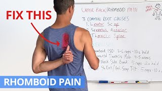 How to Fix Upper Back  Rhomboid Pain for GOOD 4 Effective Exercises [upl. by Ennovyhc]