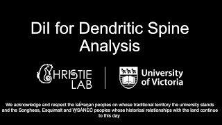 DiI for Dendritic Spine Analysis [upl. by Sitarski]