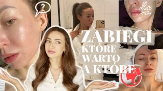 💉Zabiegi na twarz  które WARTO a które to strata pieniędzy💸 Kosmetologia i medycyna estetyczna [upl. by Larner957]