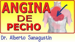 Tipos Angina de pecho [upl. by Naihtsirc]