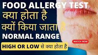 Food allergy test kaise hota hai  food allergy testing in Hindi  Allergy test kaise hota hai [upl. by Guillaume457]