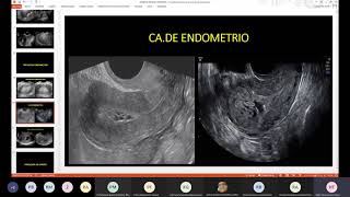 Práctica de HisterosalpingografíaHisterosonografía y rx simple de abdomen  4ta práctica Dr Amaro [upl. by Latreshia]