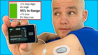 Tandem tslim x2 amp Control IQ Changed My Life  Insulin Pump Agorithm Review [upl. by Si276]