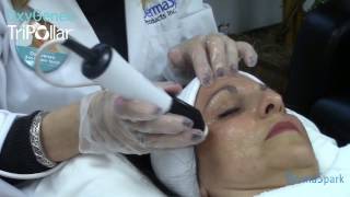 TriPollar hand piece on the OxyGeneo device  Training video by Katie Rietta DermaSpark [upl. by Justin]