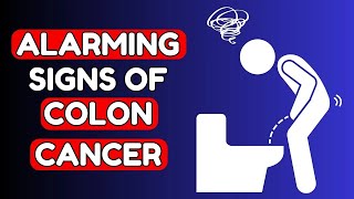 8 Warning Signs of COLON CANCER you Shouldnt Ignore  Nourish Hub [upl. by Auka886]