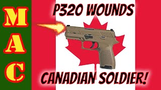 Sig P320 Discharge Wounds Canadian JTF2 Operator [upl. by Leaw]