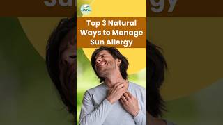 Top 3 Natural Ways to Avoid Sun Allergy Skin Rash shorts [upl. by Sundin]