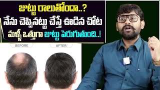 జుట్టు రాలుతోందా  Hair Fall Solution at Home in Telugu  Hair Fall Control Tips  Dr Chetan Raj [upl. by Irv]