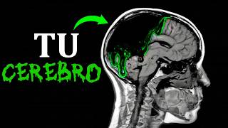 🧠 TU CEREBRO SE ESTÁ PUDRIENDO  Biología Desde Cero [upl. by Atiuqad924]