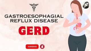 GERD  from diagnosis to treatment  everything you need to know [upl. by Rimas]