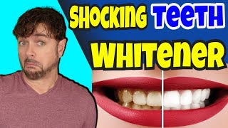 Get The WHITEST TEETH EVER In 7 Days With This NEW Kit  Chris Gibson [upl. by Kline26]