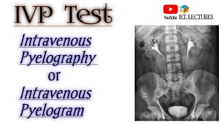 IVP testIntravenous Pyelography IVUIntravenous Urographytest Excretoru Urography test complte [upl. by Malinde]