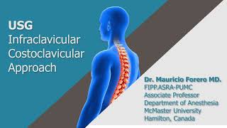 USG Infraclavicular Costoclavicular Approach [upl. by Enayd]