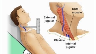 Jugular Venous Distention Explained clearly PART A Jugular venous pressure Waveform [upl. by Xirdnek]