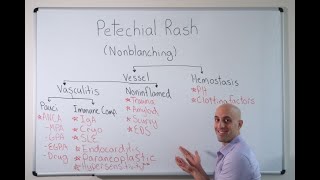 Petechial Rash  Approach [upl. by Cirilo]