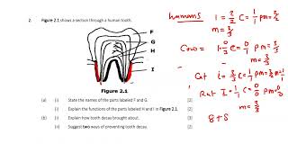 Dentition  exam questions Topic summarized [upl. by Alessig954]