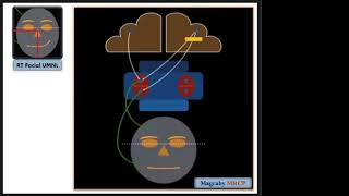 Neurology Examination MRCP PACES Lecture 9 Hemiplegia part 2 [upl. by Nyllaf]