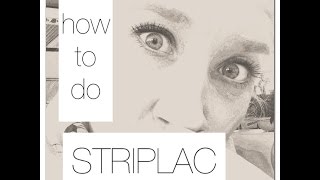 how to do STRIPLAC [upl. by Leur]