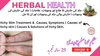 Itchy Skin Treatment amp Causes Symptoms  Causes of Itchy skin  Causes amp Solutions of Itchy Skin [upl. by Ansilma]