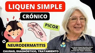 LIQUEN SIMPLE CRÓNICO o NEURODERMATITIS La piel pica se engrosa y mancha ​⁠depielapiel [upl. by Aihsenot]