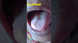 tongue fasciculation [upl. by Annorah]