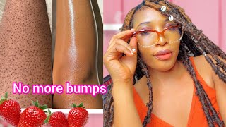 How to get rid of strawberry legs fast No more bumby skinsmooth and radiant legs [upl. by Ysak]