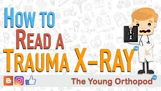 How to Read an X RAY Trauma Radiograph  The Young Orthopod [upl. by Lathe421]