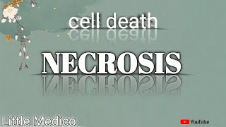 Types of Necrosis part2 [upl. by Frager698]