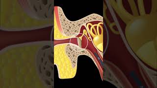 RETRACTED EARDRUMRETRACTION POCKETS EXPLAINED SHORTS [upl. by Enohpets]