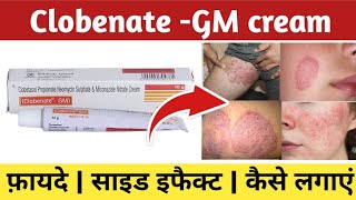 Clobenate gm cream ke fayde  Clobenate gm cream kis kaam aati hai  Clobenate gm cream uses [upl. by Fillander]