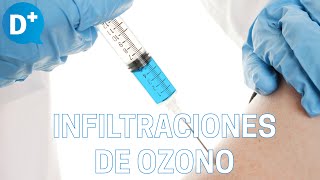 ¿Qué son las infiltraciones de ozono [upl. by Ehman]