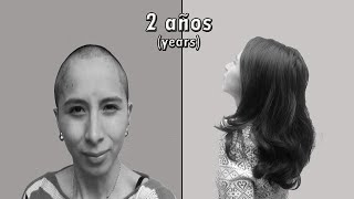 2 Años de Crecimiento del Cabello Timelapse 💇💇 [upl. by Asirrak997]