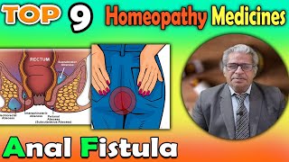 Anal Fistula Causes Symptoms and homeopathy Treatment  Dr P S Tiwari [upl. by Freeman]