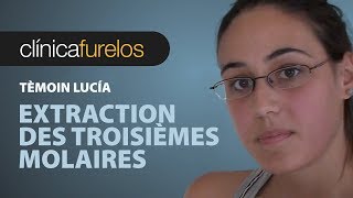 Lucia Extraction des troisièmes molaires [upl. by Suhail706]