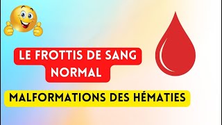 Le frottis de sang normal et Malformations des hématies [upl. by Bethesde]