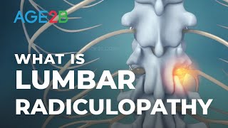 What Is Lumbar Radiculopathy  Lumbar Nerve Roots  Disc Bulge [upl. by Ozzy]