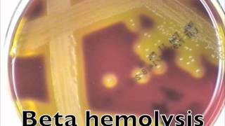 Comparison of hemolysis on blood agarmov [upl. by Eramat]